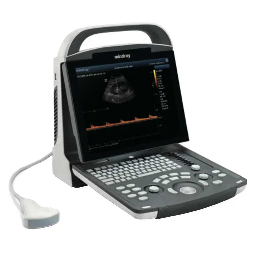 Mindray DP20 Power Diagnostic UltraSound Advanced Imaging Technologies,B/W ultrasound,compact ergonomic design,Diagnostic Imaging System,Digital Ultrasonic Diagnostic Imaging System,DP-20 Power edition,Good image quality,iClear for Speckle Reduction Imagi