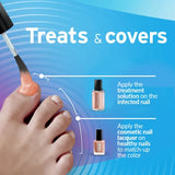 Excilor Ultra Color Nude