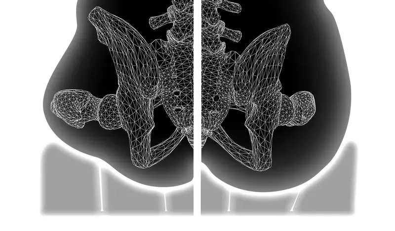 Allied Medical Ki Mobility Axiom Air LTE Cushion easy-to-use hand pump,interconnected 3" air cells,lightweight cushion