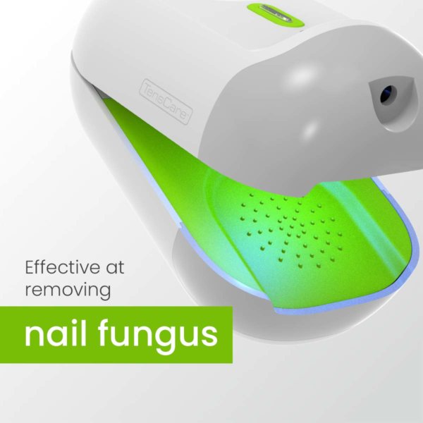 Nailit Laser Therapy for Fungal Nails – Painless Safe & Effective