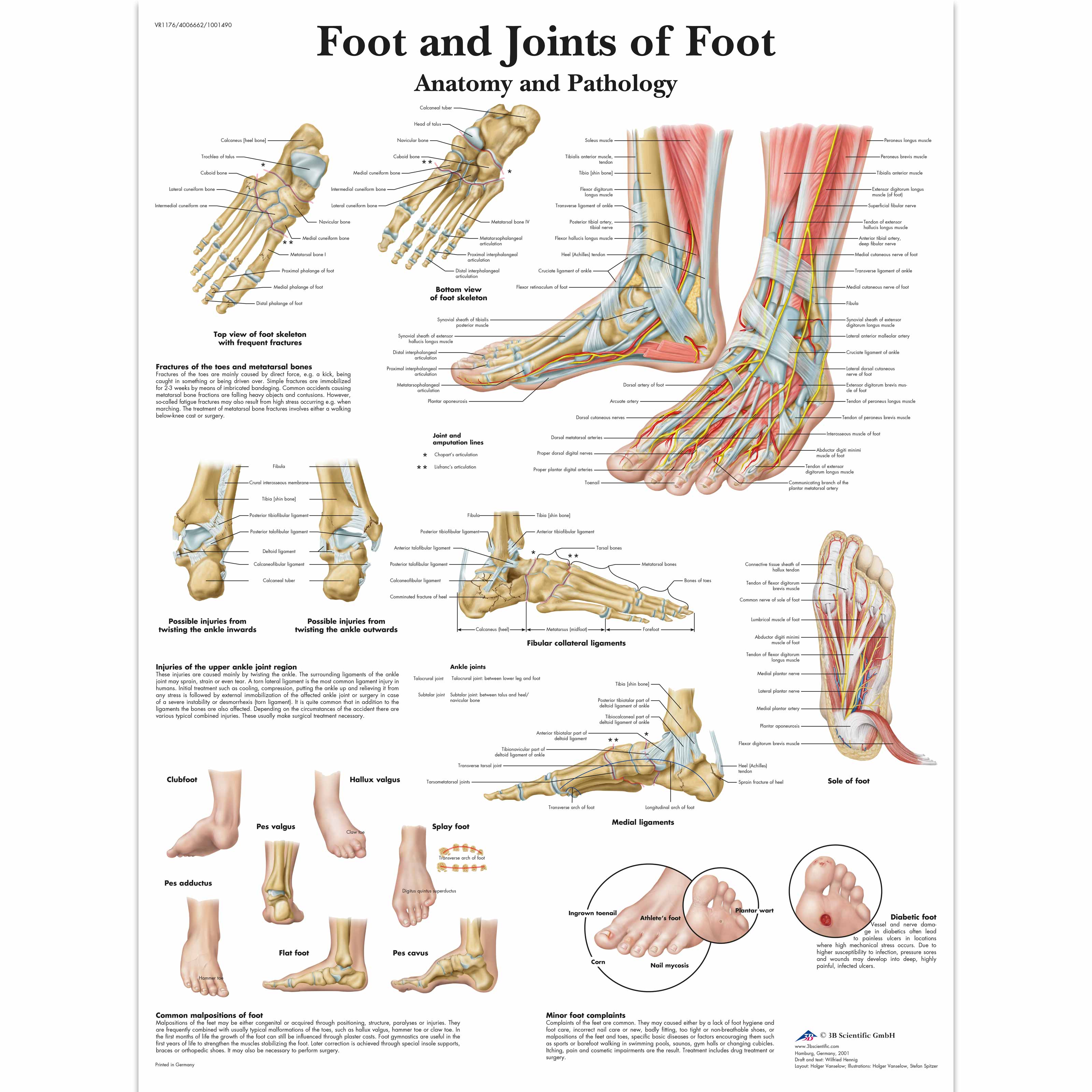 Chart Foot & Joints Of Foot - Anatomy & Pathology