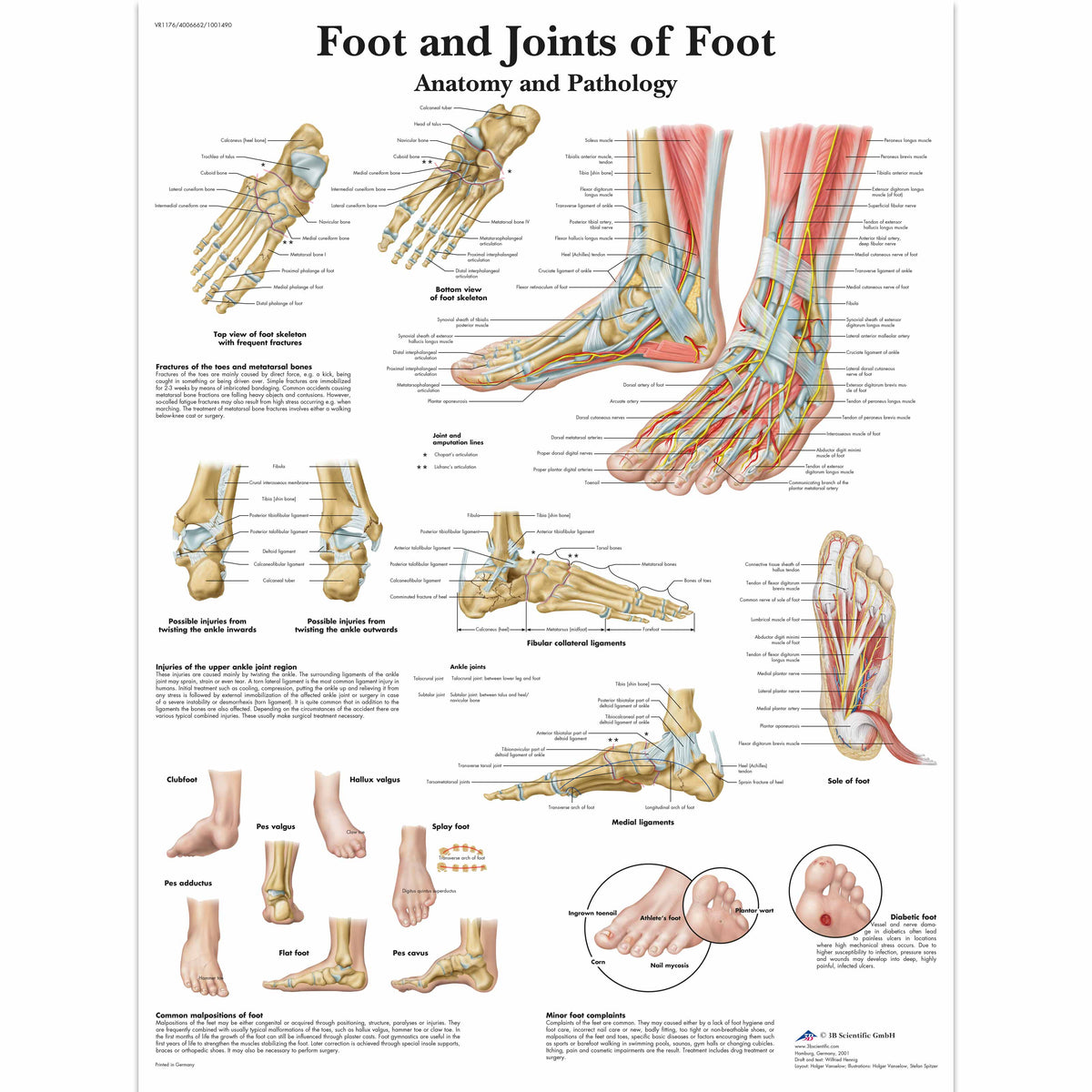 Chart Foot & Joints Of Foot - Anatomy & Pathology