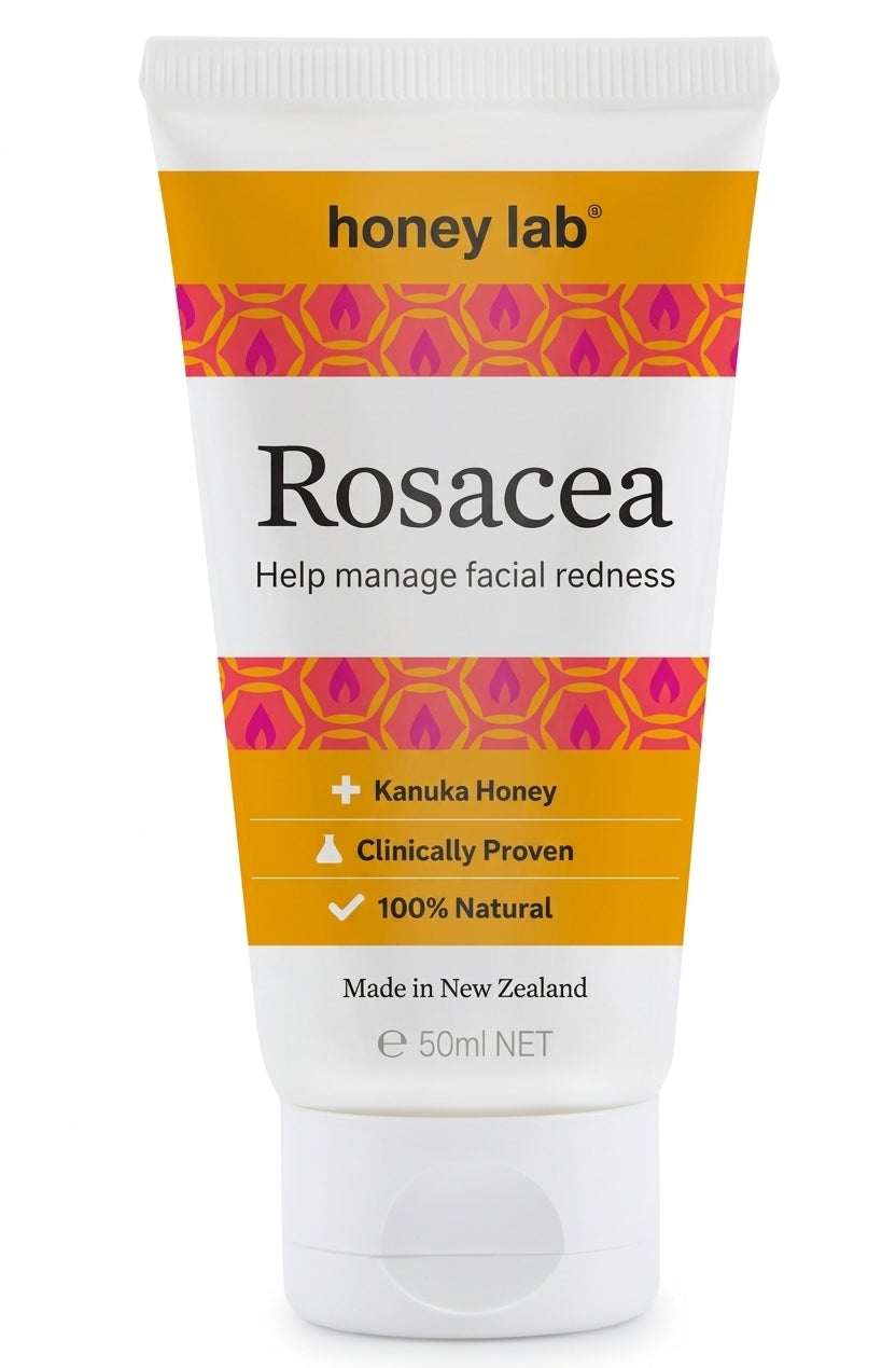 Rosacea 50ml