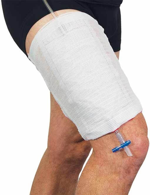 Advance&reg; Urine Bag Leg Holder